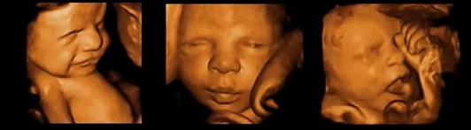 高清四维彩超效果图